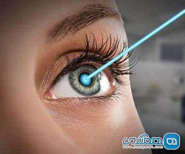 لازک و لیزیک؛ هر دو نوع جراحی چشم را بهتر بشناسید