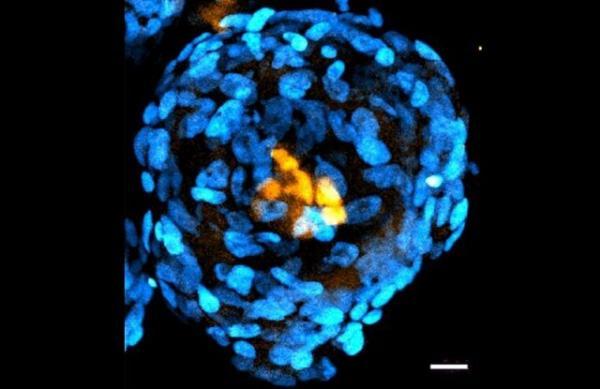 ایجاد ساختاری مشابه جنین انسان از سلول های بنیادی