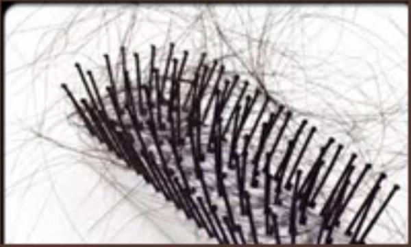 علل ریزش مو در نوجوانان